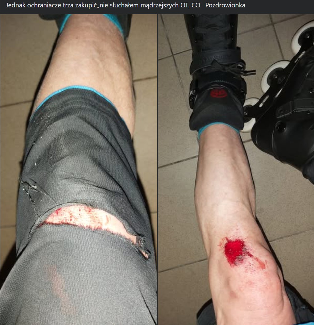 Dlaczego warto nosić ochraniacze na rolki