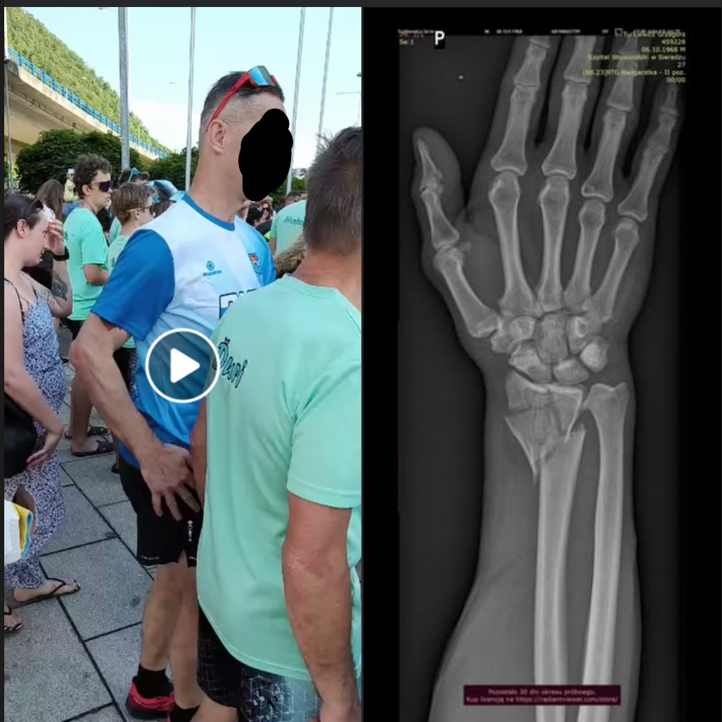 Dlaczego warto nosić ochraniacze na rolki
